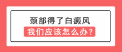 白癜风医生李瑞斌：颈部得了白癜风我们应该怎么做？