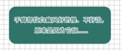 白癜风医生白淑芳：手脚部位白癜风好的慢、不好治，原来是因为它们......