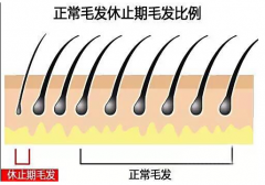 脱发危机到来？贝妮芙小黑瓶扫清毛囊障碍·助阵茂密生发