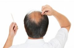 脱发的预兆你知晓吗？自然丝带您梳理清楚！