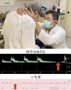 坐立时突然严重头晕目眩？小心惊厥性晕厥综合症
