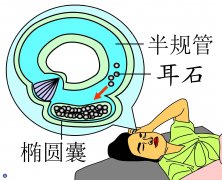 <晕眩耳鸣专栏>旅行前如何预防眩晕？医师建议这些措施